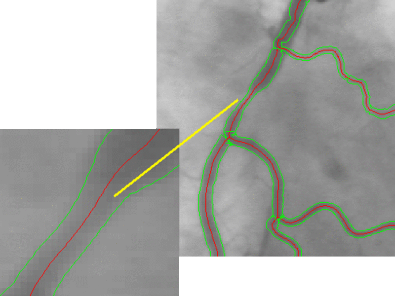 Angiografie