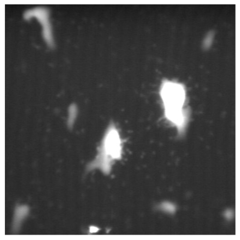 Blob Analysis